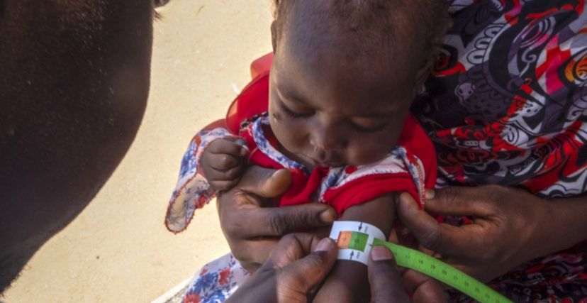 فحص حجم ذراع طفل سوداني لاجئ يعاني من سوء التغذية